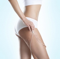 Липосакция